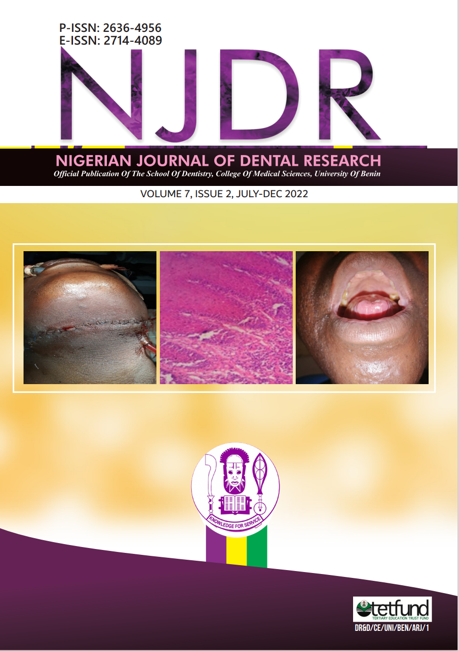 					View Vol. 7 No. 2 (2022): Nigerian Journal of Dental Research
				